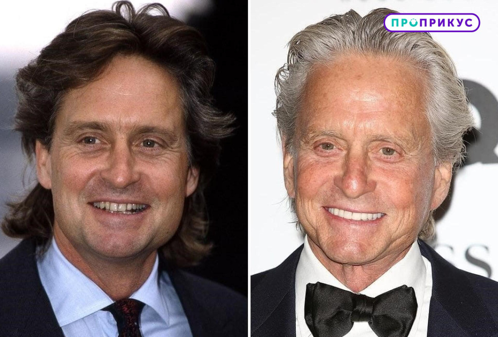 голливудская улыбка до и после (актеры) - изображение 2