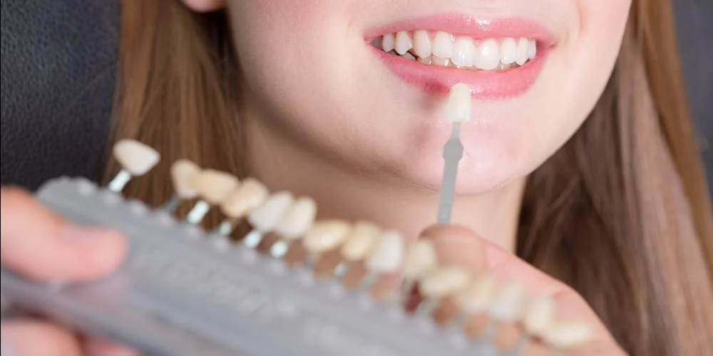 исправить зубы без брекетов