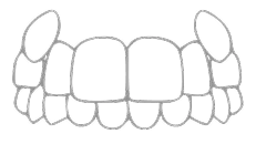 «Хищные» клыки