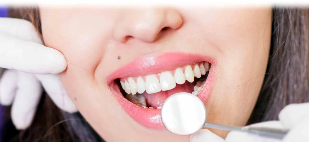 лечение пломбой