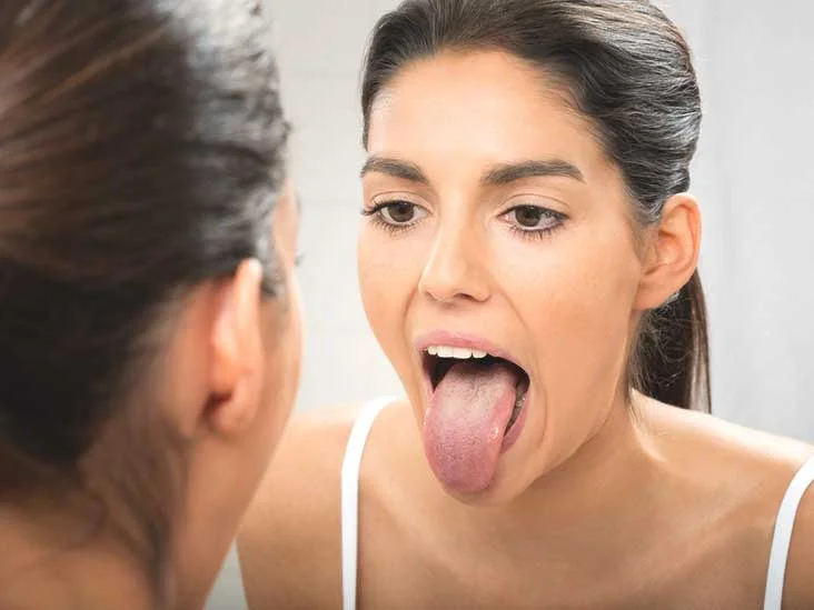 язык желтый налет причины фото