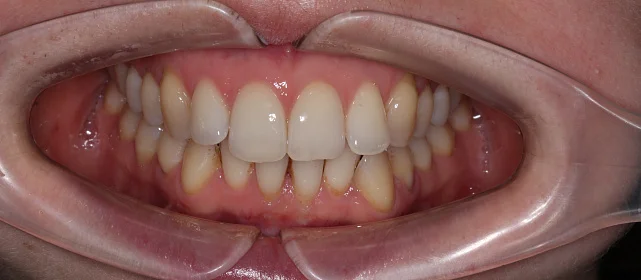 Лечение на Star Smile