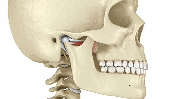 Височно-нижнечелюстной сустав фото