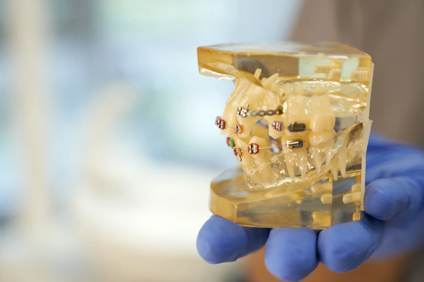 Челюсть человека