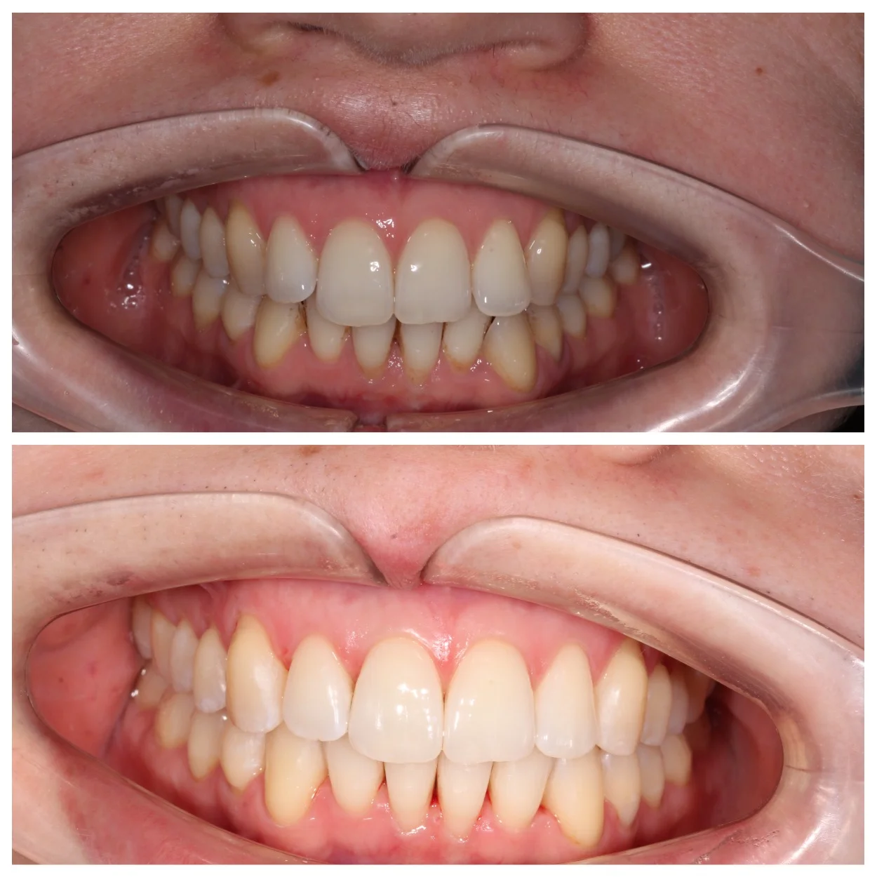 Лечение на Star Smile