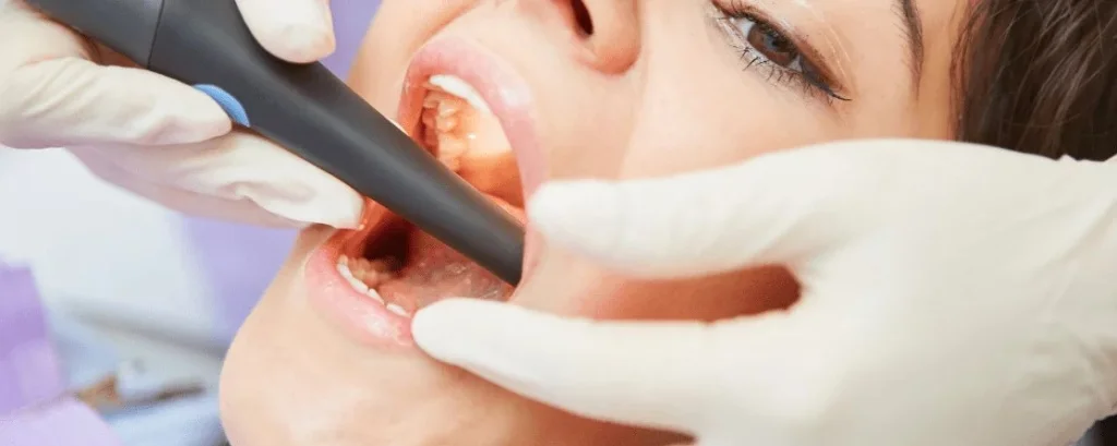 лечение гингивита фото