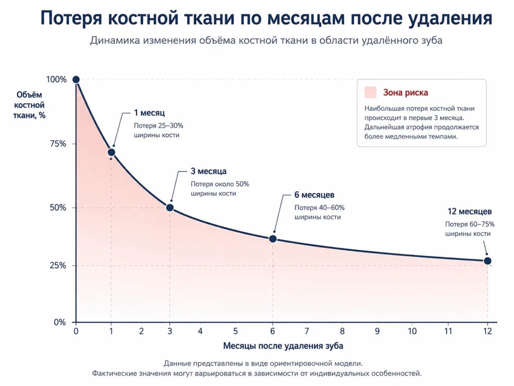 Потеря костной ткани по месяцам после удаления зуба.png
