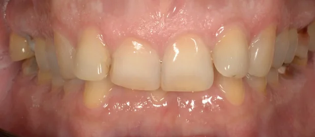 Реабилитация возрастных пациентов  