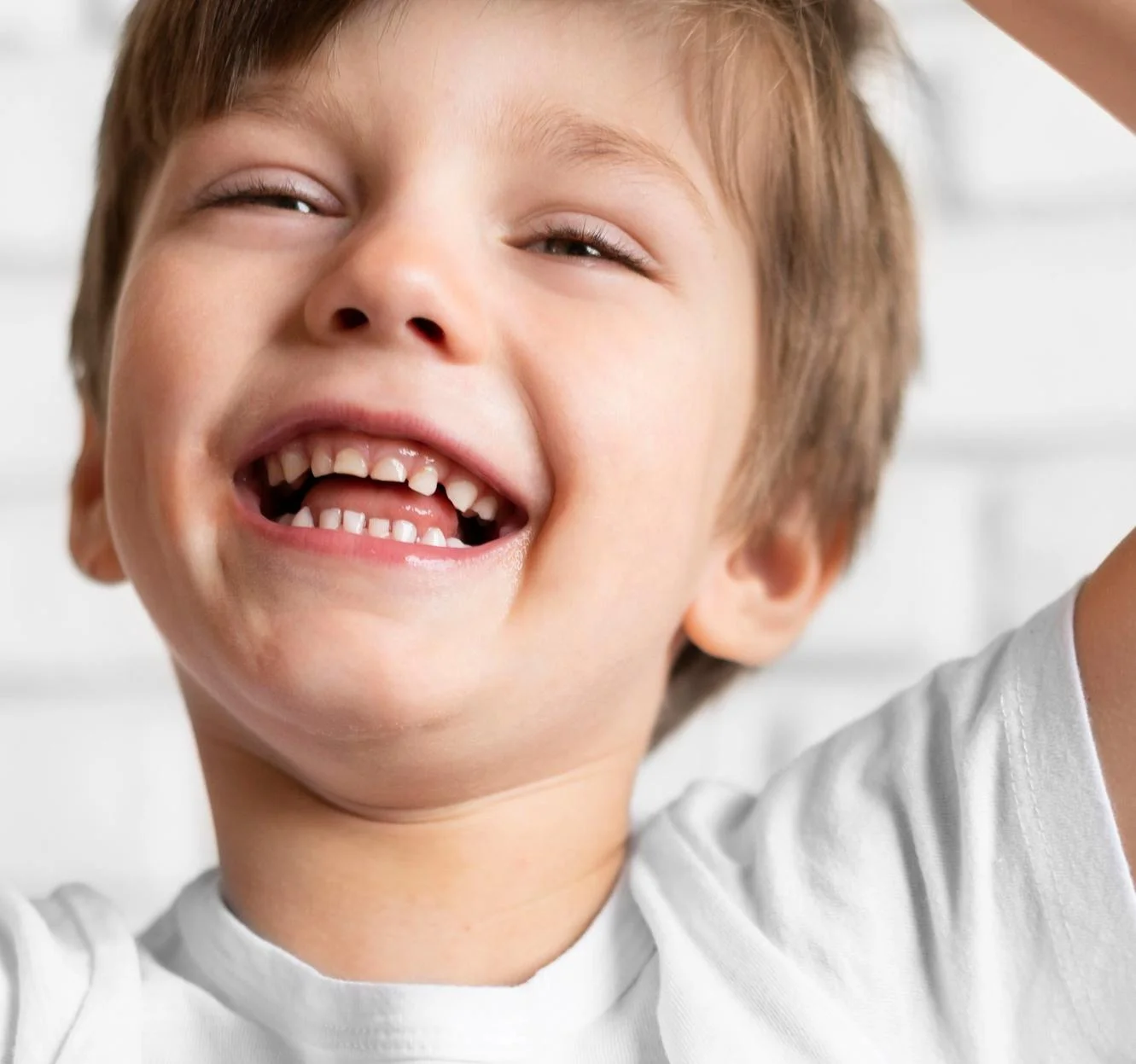 «Акулья улыбка» у детей