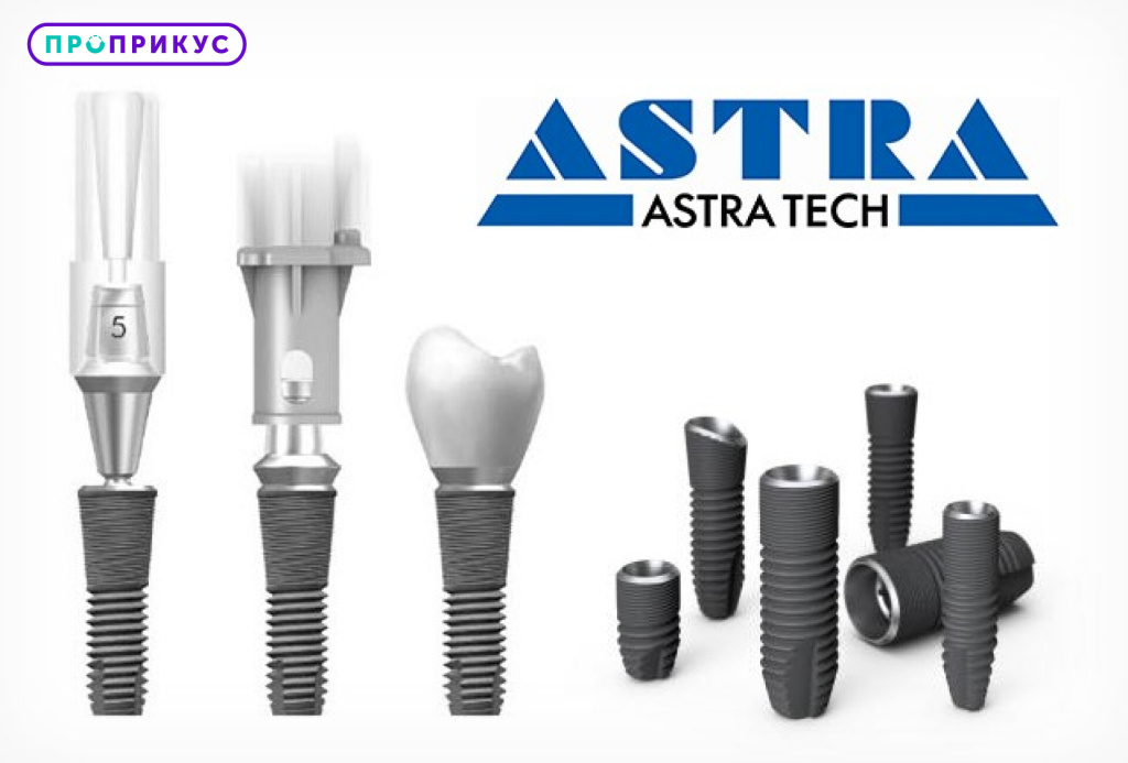 Импланты Astra Tech