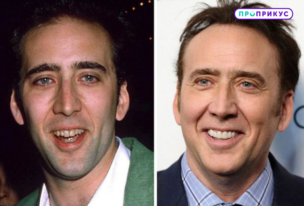 голливудская улыбка до и после (актеры) - изображение 1