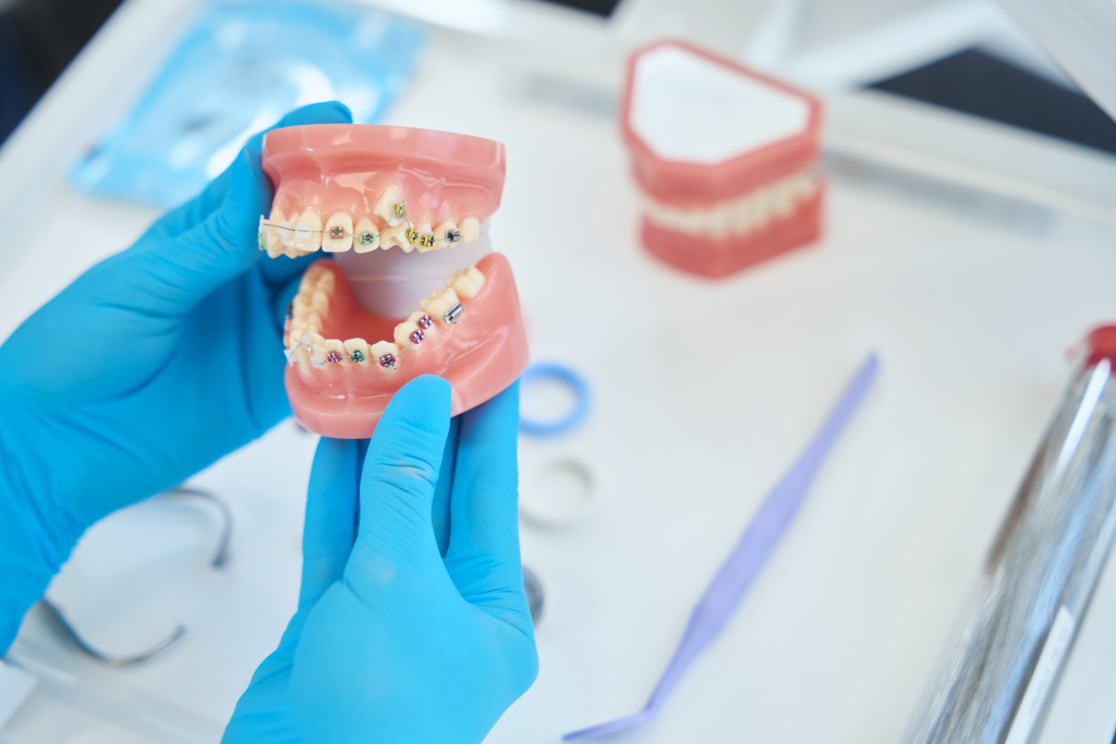 Зачем нужен ортодонтический воск
