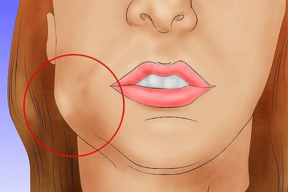 Гемостатическая губка после удаления зуба: зачем нужна и когда рассосется