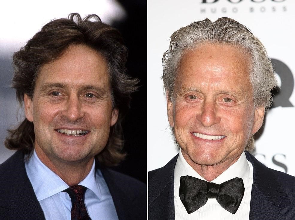 голливудская улыбка до и после (актеры) - изображение 2