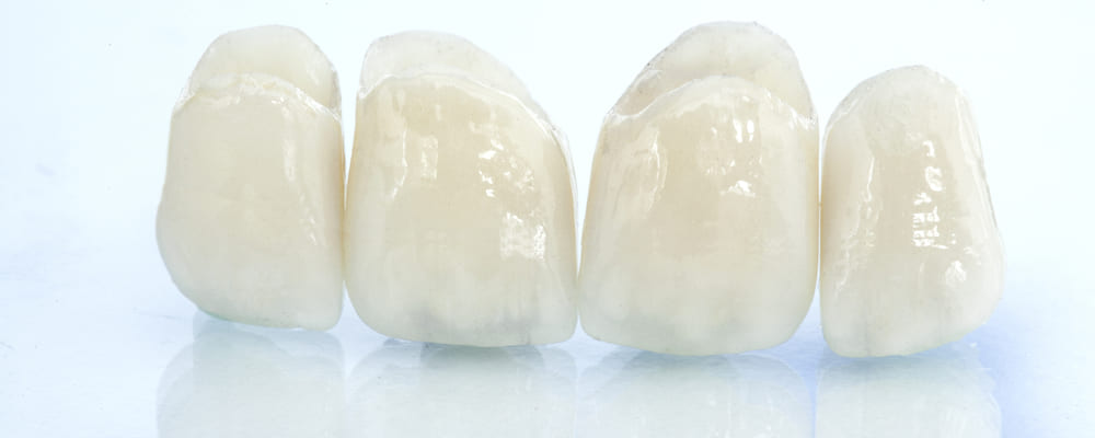 Керамические коронки на зуб