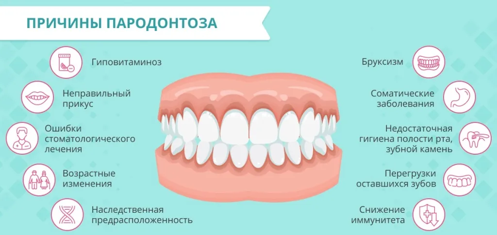 Пародонтоз: причины, симптомы, лечение